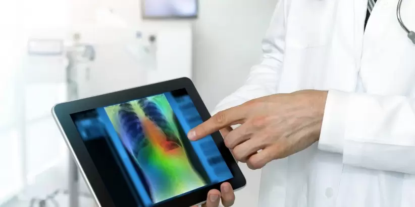 cancer pulmon tecnologia